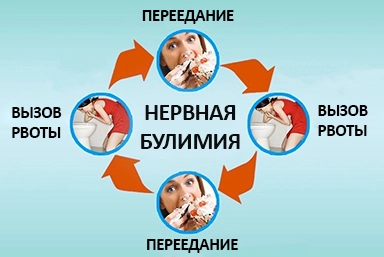 Лечение булимии в Белоярском